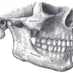 Jaw Bone Grafting Raleigh, NC